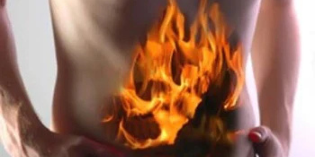 Bare abdomen with superimposed flames over the stomach, illustrating heartburn and low stomach acid.