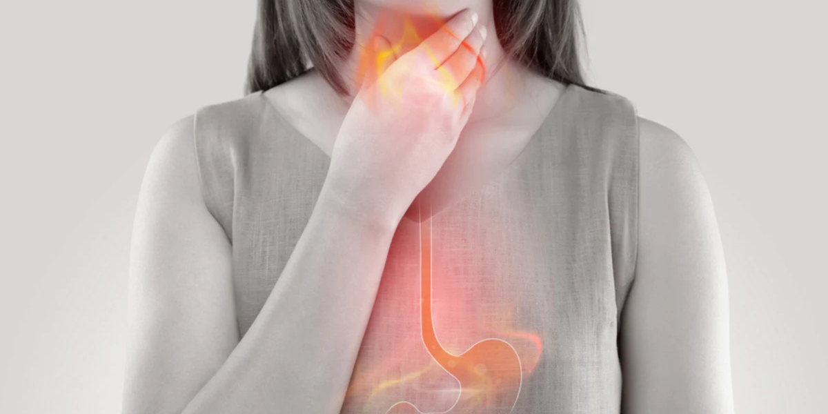 Person clutching throat with highlighted esophagus and stomach showing a burning sensation