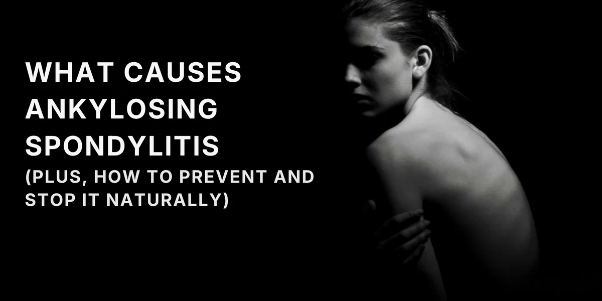 Shadowed woman's back beside headline WHAT CAUSES ANKYLOSING SPONDYLITIS (PLUS, HOW TO PREVENT AND STOP IT NATURALLY)