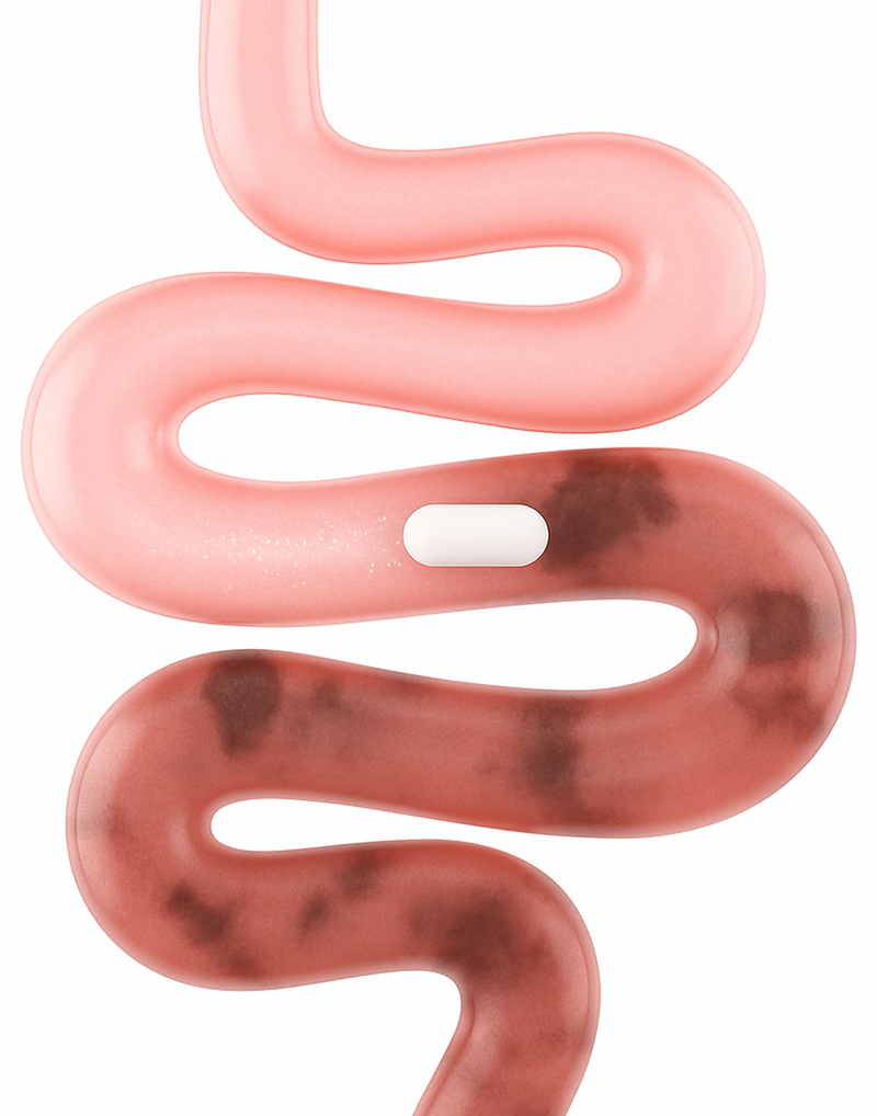 Winding pink intestine illustration with a white capsule lodged inside and dark patches suggesting unhealthy areas.