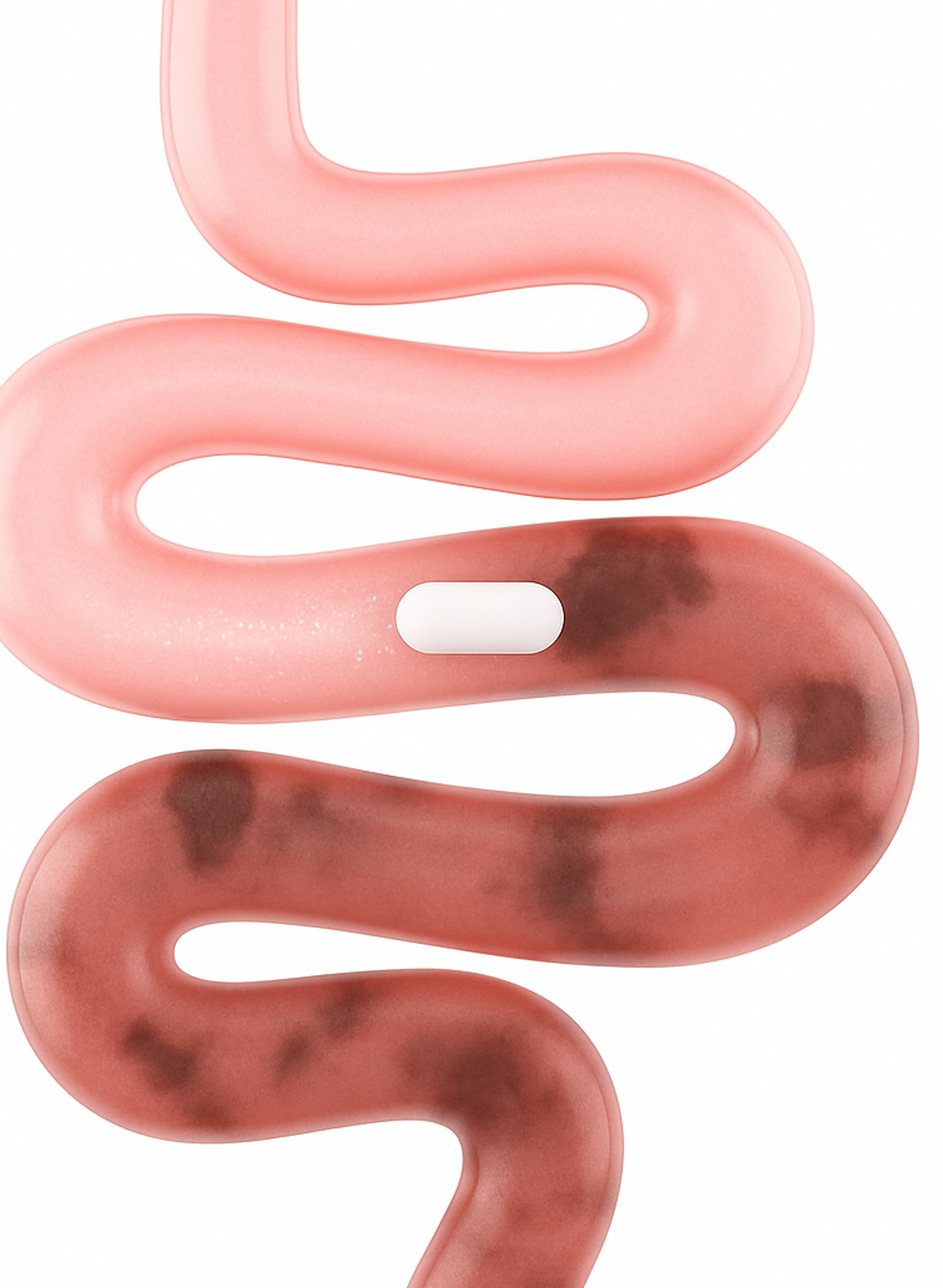 Winding pink intestine with a white pill and dark blotches suggesting inflammation and a disrupted gut microbiome