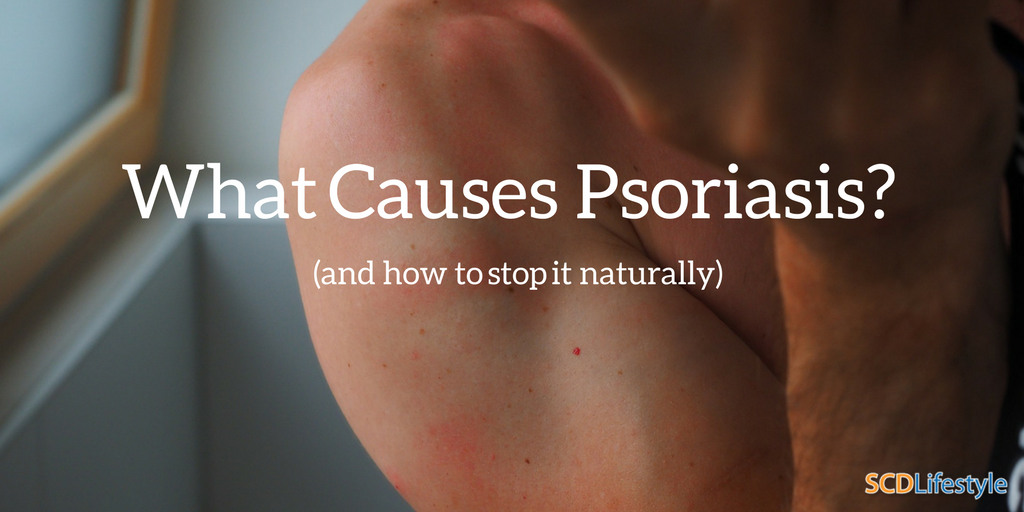 What Causes Psoriasis? (and how to stop it naturally)